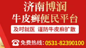 及时就医 谨防牛皮癣复发