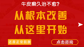 牛皮癣久治不愈？
