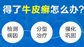 得了牛皮癣怎么办？