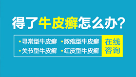 牛皮癣类型