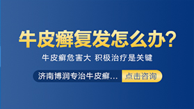 牛皮癣复发怎么办？